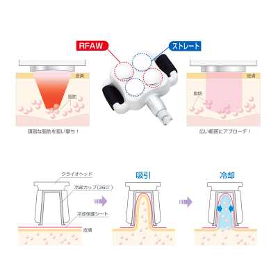 キャビクライオプロ -CAVI CRYO PRO-/美容専門総合商社 キャビクライオプロ -CAVI CRYO PRO-/美容専門総合商社